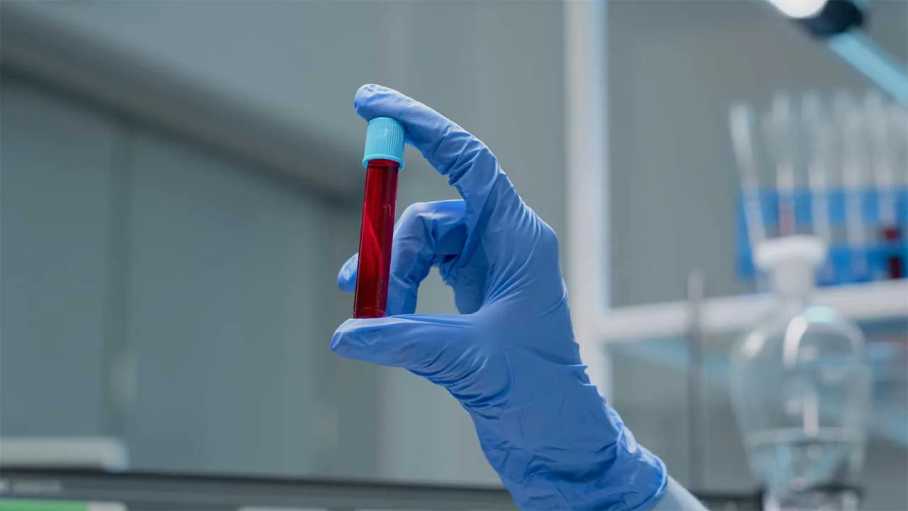 Imagem destacada de Abrasta lança estudo sobre a talassemia no Brasil