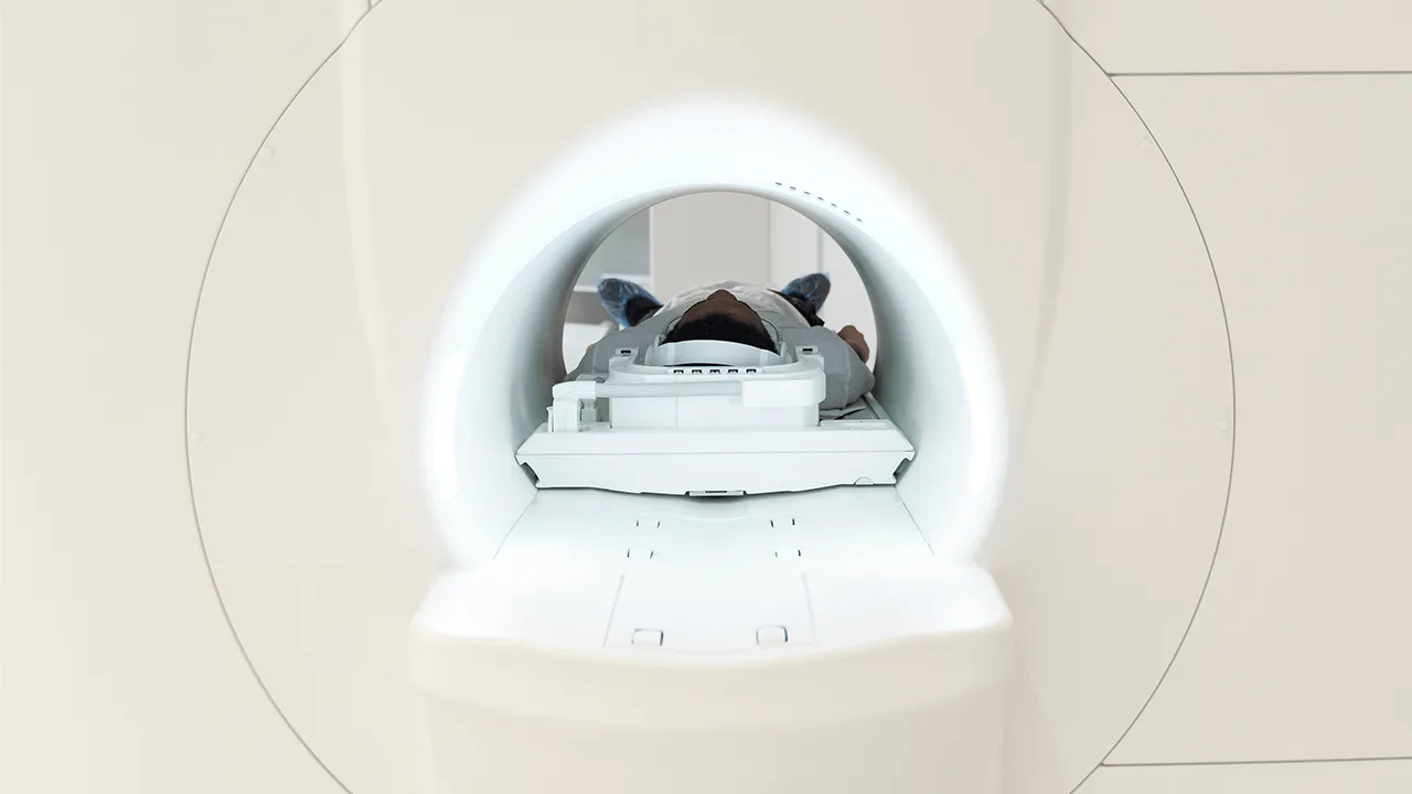 Imagem destacada de Sua ressonância magnética T2* está em dia?
