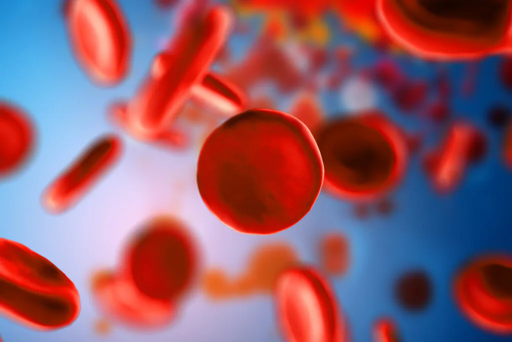 Imagem 2 de Talassemia Maior