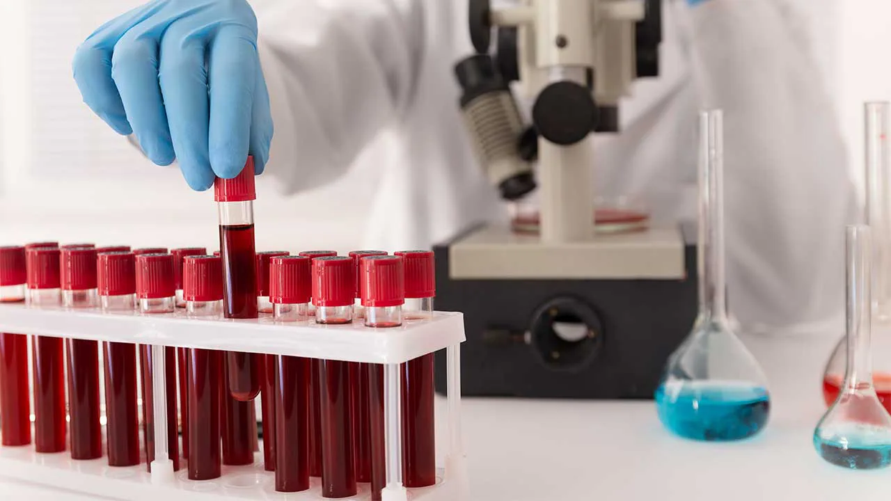 Imagem destacada de Nova lei cria o Dia Nacional do Hematologista e do Hemoterapeuta